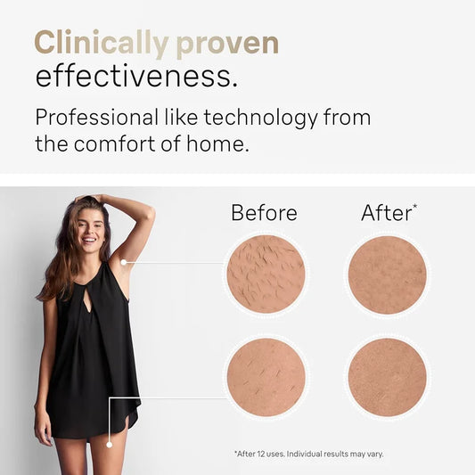 Permanent Laser Hair Removal Female